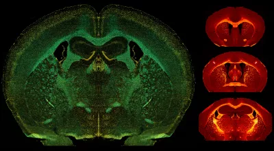 Brain image under microscope